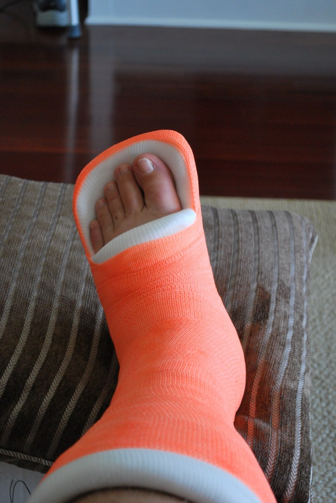 Broken Leg (January 2009)